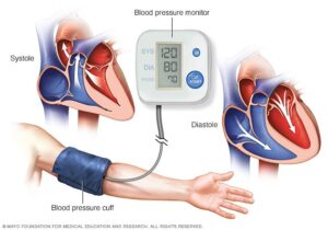 blood pressure monitor